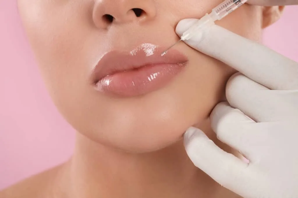 Increasing the volume and shaping of the lips