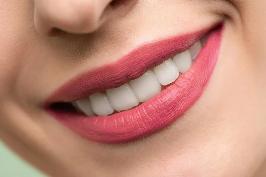 مراقبت‌های بعد از فیلر خط خنده: 10 توصیه‌ی مراقبتی